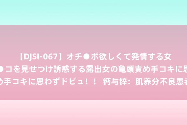 【DJSI-067】オチ●ポ欲しくて発情する女たち ところ構わずオマ●コを見せつけ誘惑する露出女の亀頭責め手コキに思わずドピュ！！ 钙与锌：肌养分不良患者必补的矿物资